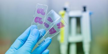 Problem-Solving Classical Histopathology with IR Imaging Microscopy